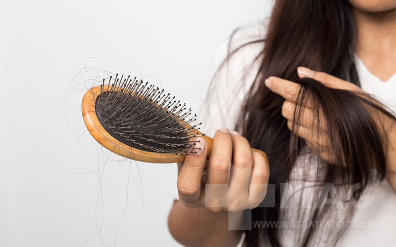 جلوگیری از ریزش مو