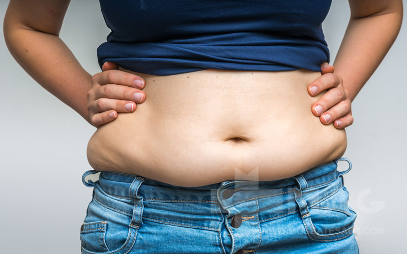 belly-fat