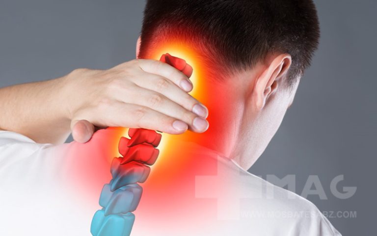 آرتروز گردن