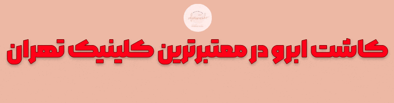 کاشت ابرو