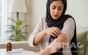 بهترین قرص برای درمان کهیر